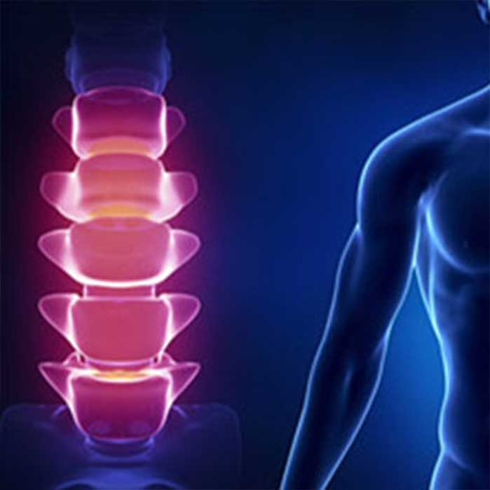 Chiropractic care for lower back pain in Louisville